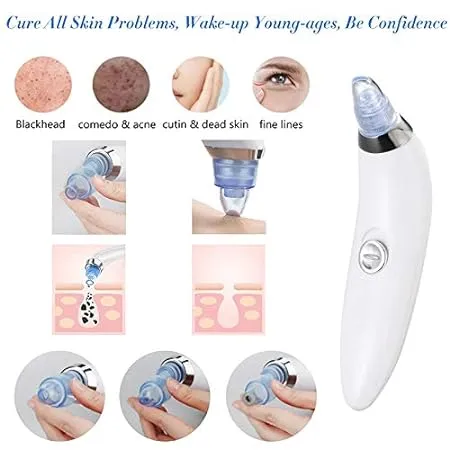 0351 -4 In 1 Blackhead Whitehead Extractor Remover Device Acne Pimple Pore Cleaner (Vacuum Suction Tool)